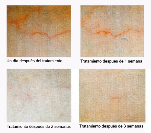 antes y después